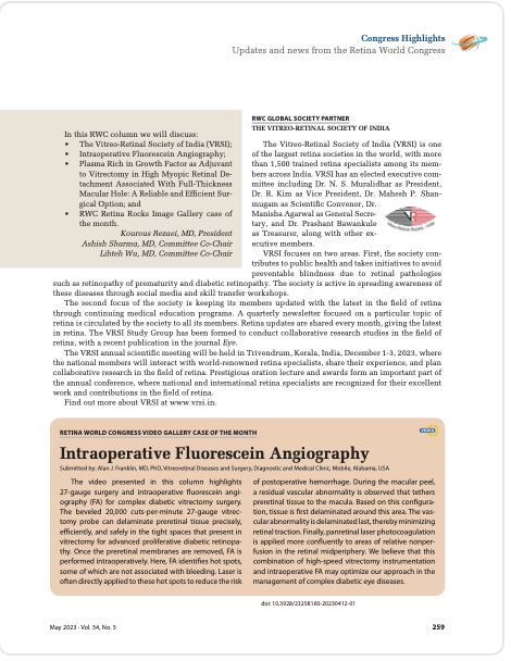 RWC Update: Intraoperative Fluorescein Angiography, Plasma Rich in Growth Factor as Adjuvant to Vitrectomy in High Myopic Retinal Detachment Associated with Full-Thickness Macular Hole, Giant Tear of the Retinal Pigment Epithelium