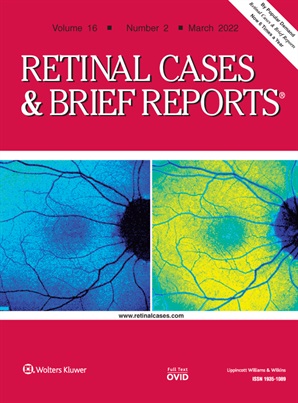 Plasma Rich in Growth Factors for Persistent Macular Hole: A Pilot Study