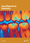Oral Squamous Cell Carcinoma in Atrophic-Erosive Lichen Planus: 10-Year Rehabilitative Case Report