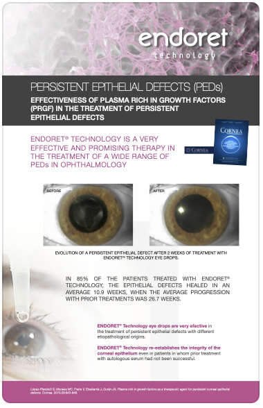 Plasma rich in growth factors as a therapeutic agent for persistent corneal epithelial defects