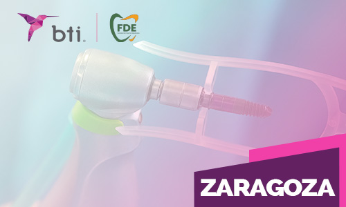 Actualización de implantes cortos y regeneración ósea [Zaragoza]