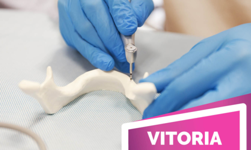 BTI Implant System – Avanzado [octubre 2026]