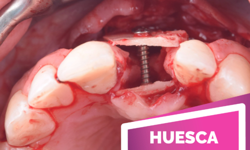I CLINICAL FORUM | Ciudad de Huesca