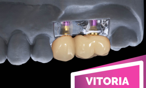 Actualización en prótesis dental e implantoprótesis: tendencias y desafíos clínicos
