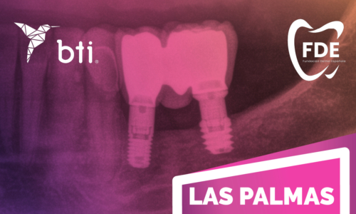 Actualización de implantes cortos y regeneración ósea [Las Palmas] [2026]