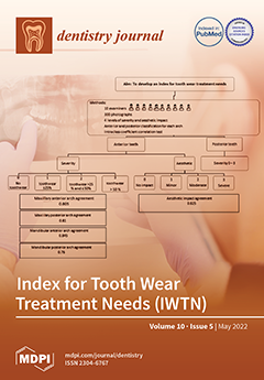 Influence of Implant Tilting and Length on the Biomechanics of Single-Tooth Restoration: A Finite Element Analysis in Atrophic Mandible