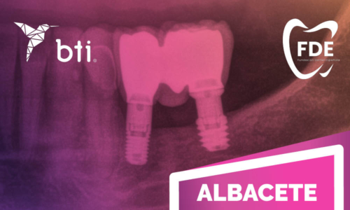 Jornada de actualización de implantes cortos y regeneración ósea [Albacete] [2026]