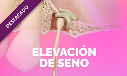 Elevación de seno