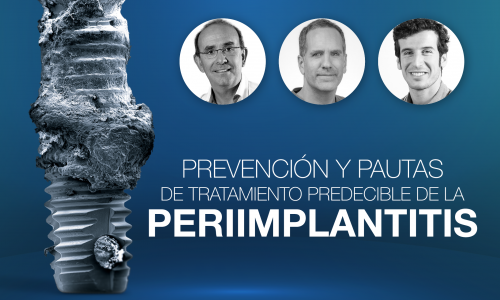 Prevención y pautas de tratamiento predecible de la periimplantitis