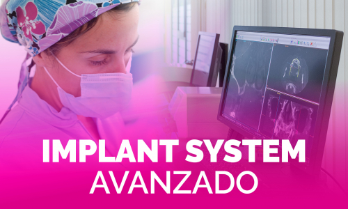 BTI Implant System – Avanzado [mayo 2022]