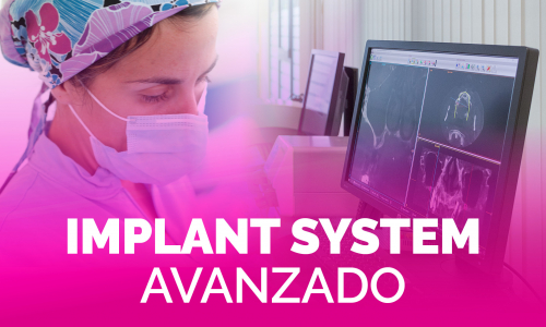 BTI Implant System – Avanzado [enero 2023]