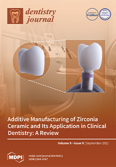 Influence of Dental Implant Diameter and Bone Quality on the Biomechanics of Single-Crown Restoration. A Finite Element Analysis