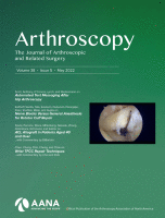 Office-Based Intraosseous Infiltrations of PRGF in Knee Osteoarthritis: Description of Technique