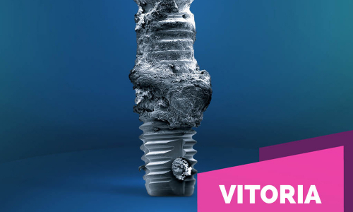 Prevención y pautas de tratamiento predecible de la periimplantitis – CURSO COMPLETO