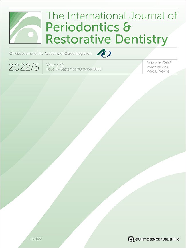 Single-Unit Short Implants in the Molar Region: A Retrospective Study with a Minimum 3-Year Follow-up