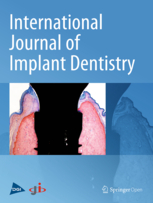 Clinical performance of additively manufactured subperiosteal implants: a systematic review