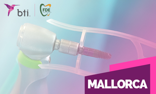 Actualización de implantes cortos y regeneración ósea [Mallorca]